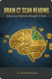Brain CT Scan Reading